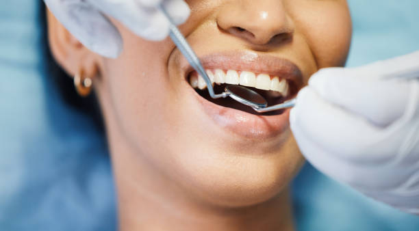 Best Emergency Treatment for Dental Infections or Abscesses in St Andrews, SC