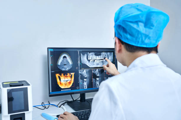 Best Emergency Dental Care for Broken or Chipped Teeth in St Andrews, SC